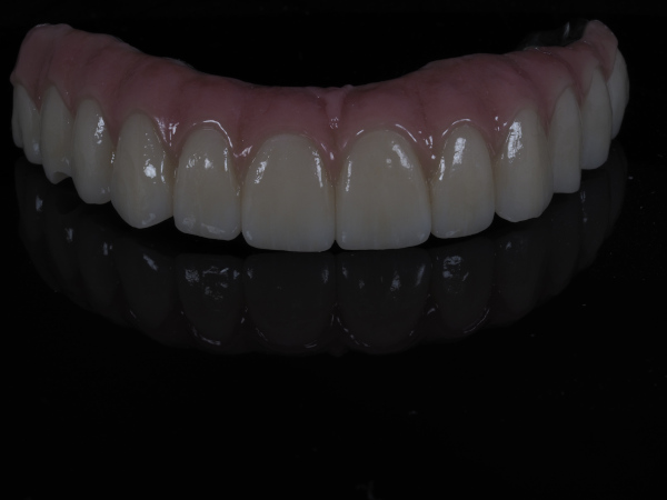fija_zirconio_ceramica