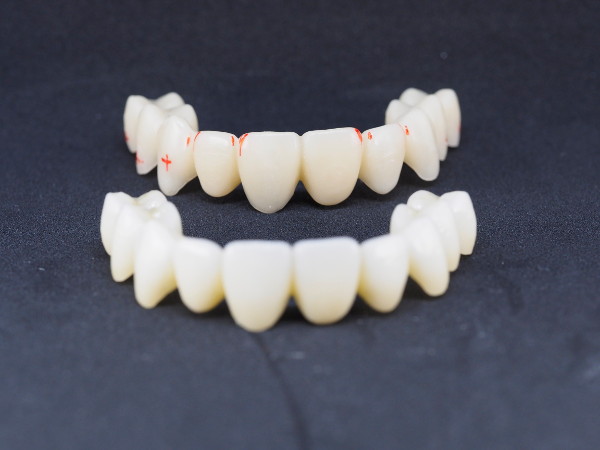 fija_zirconio_ceramica