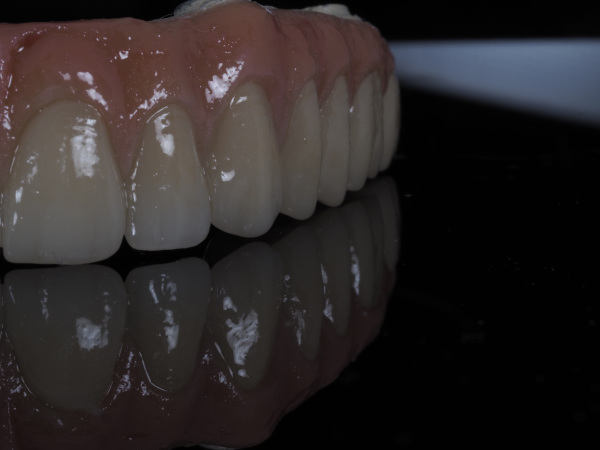 implante_hibrida