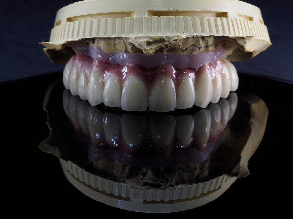 implante_metal_ceramica